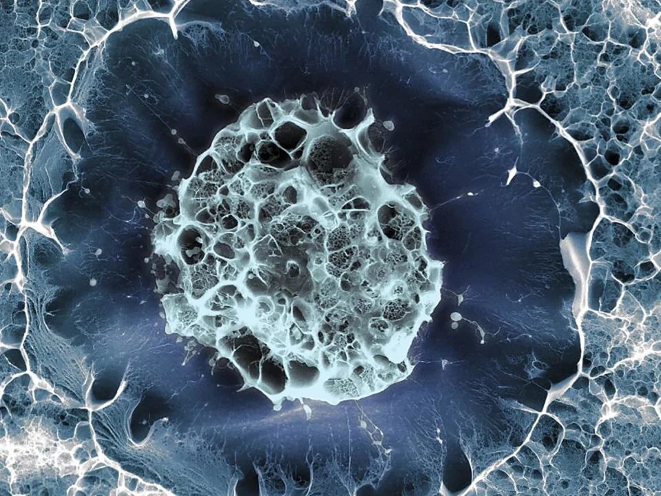 celulas madre puerto vallarta2